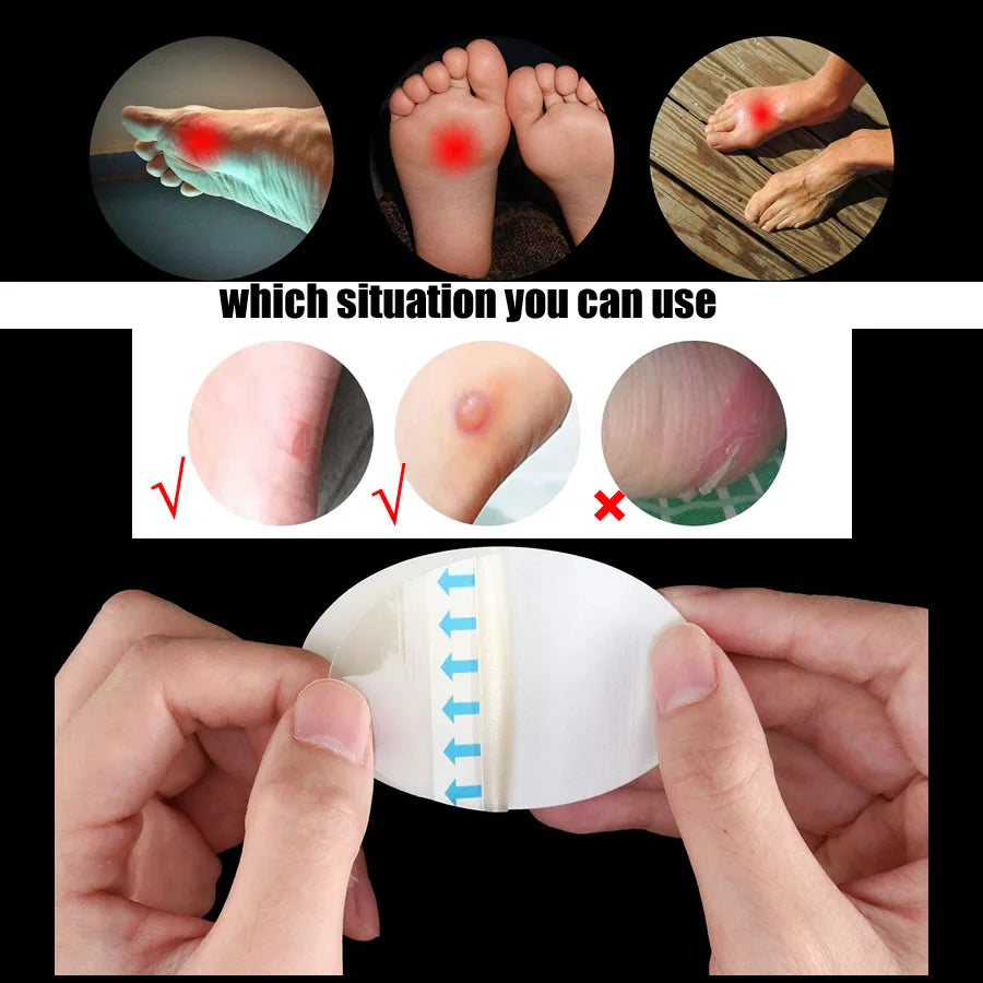 5pcs Hydrocolloid Dressing Heel Tape Anti-Wear Band-Aid Adhesive Bandage First Aid kit Home Travel Outdoor Camp Emergency Kits Vue