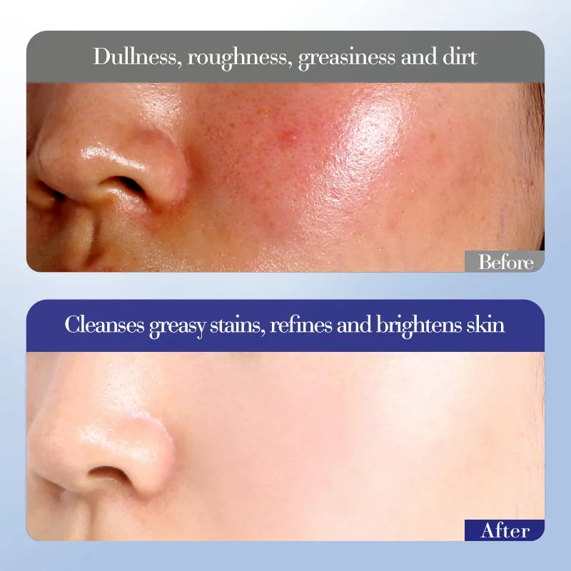 Sadoer Evening Primrose Vitamin E High Moisturizing and Hydrating Six-Piece Set, Deeply Cleanses the Skin, Removes Oil from the Skin, Makes the Skin White and Translucent, Soothes and Softens the Skin, Nourishes and Moisturiz Vue