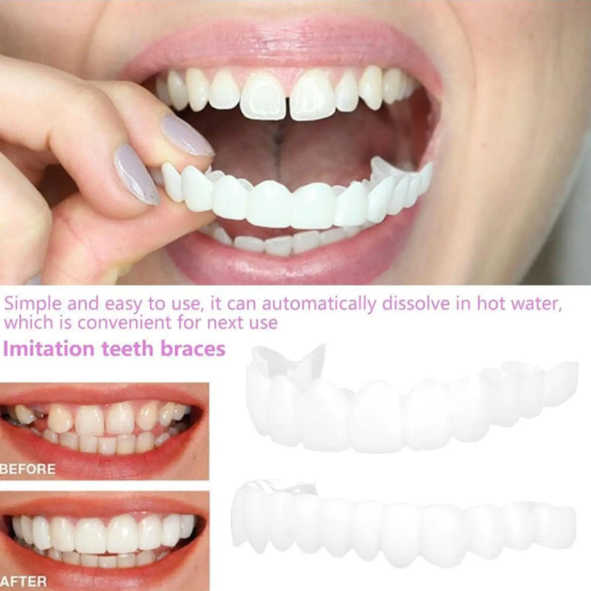 1 pair Teeth Veneers Men Women Brightening Dentures Temporary False Teeth Cover Instant Imitation Braces For Confidence Smile Vue