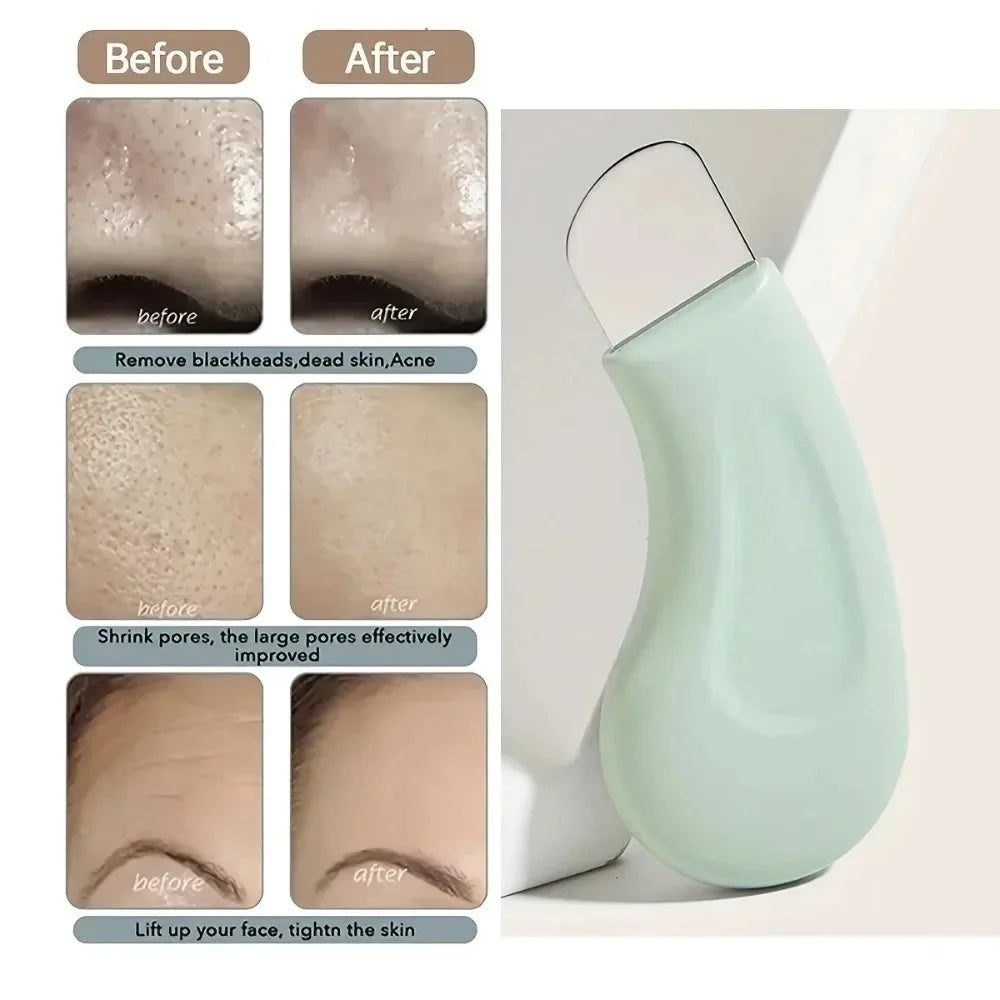 1pc Removing Blackheads Scraper Manual Blackhead Blackhead Remover Cleaning Facial Beauty Tool for Removing Acne and Dead Skin Vue