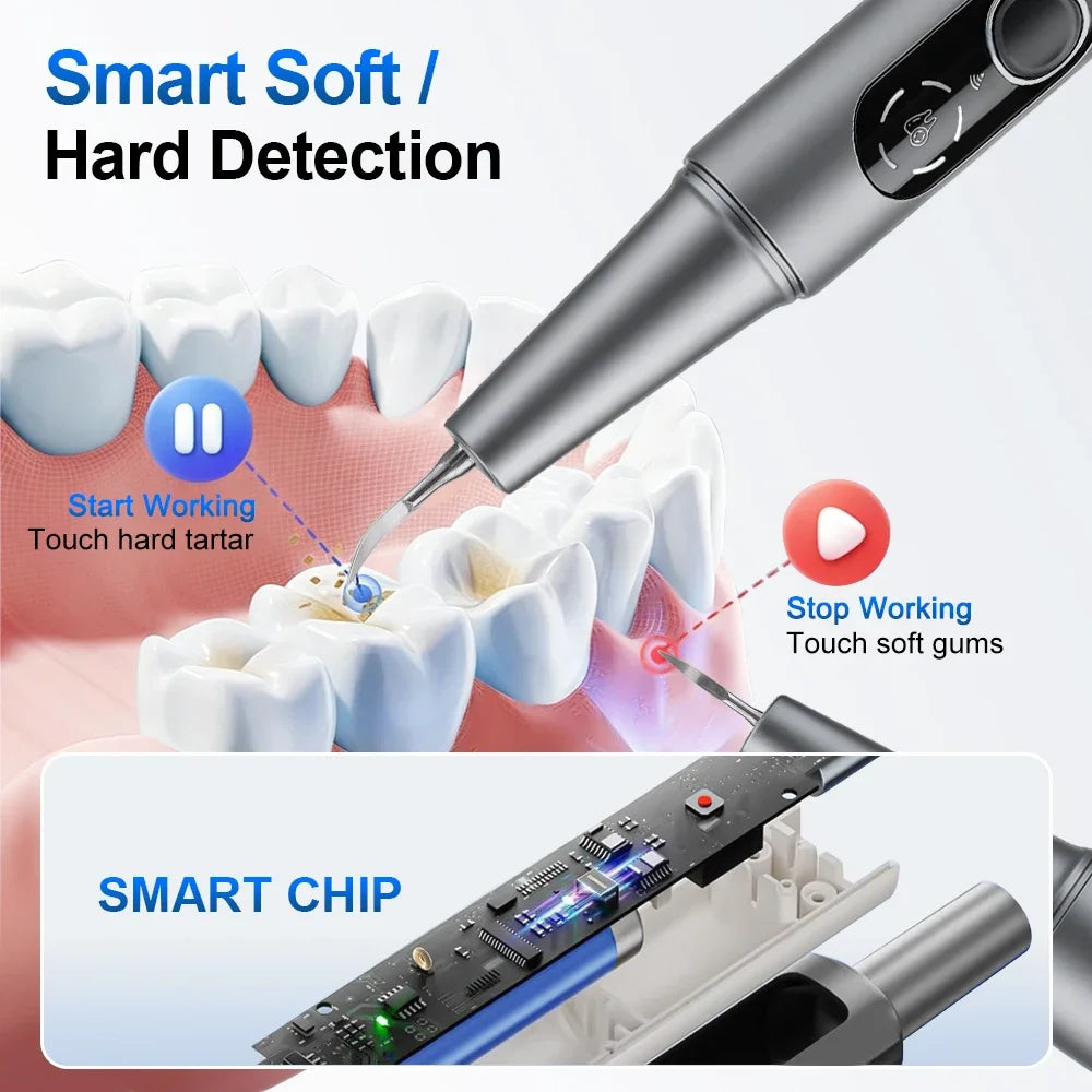 Electric Visual Ultrasonic Dental 5 Mode Scaler Teeth Tartar Removal IPX6 Waterproof Teeth Cleaning Tools Oral Care WiFi Cleaner Vue