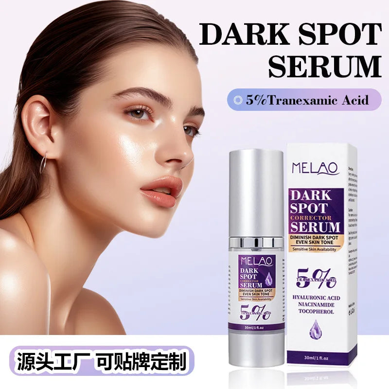 Dark Spot Remover for Face,Dark Spot Corrector Serum for Age Spot Sun Spot Freckles Melasma Brown Spot Skin Care Repair Cream Vue