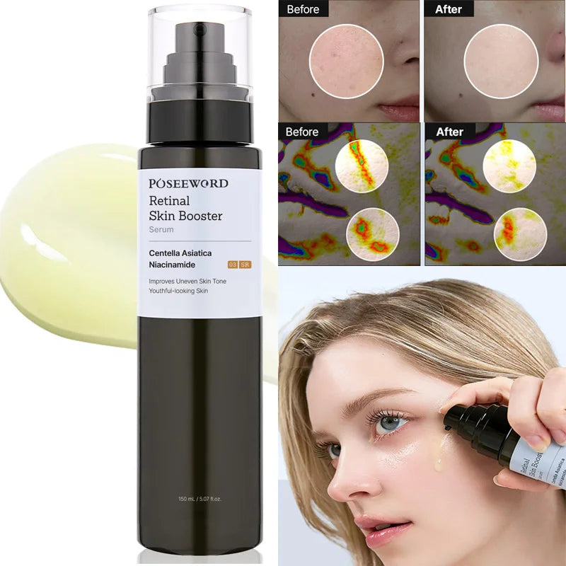 150ml Glow Intensive Retinol Skin Boosting Serum Fading Dark Spot Balancing Skin Tone Improve Fine Line Brightening Skin care Vue