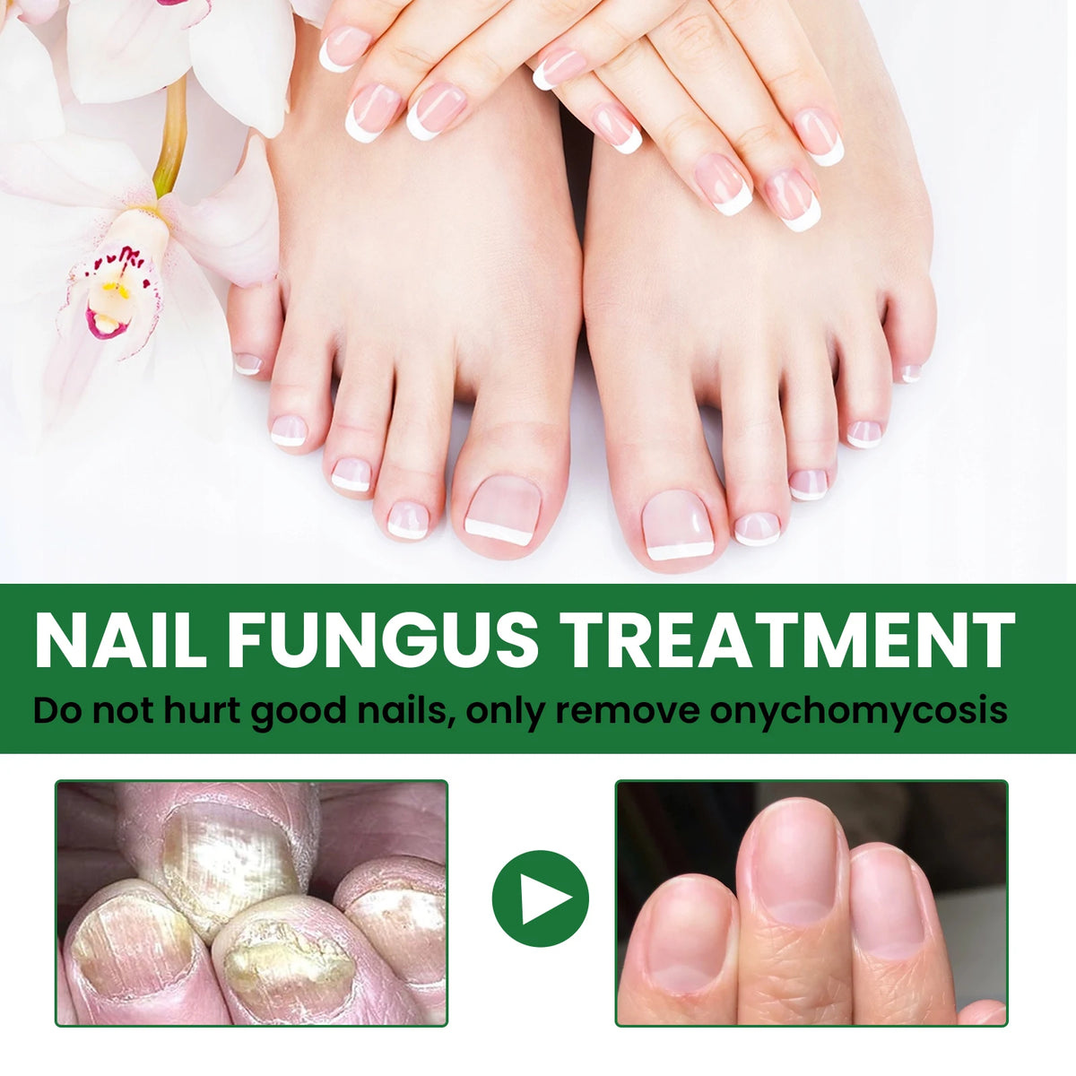 Nail Repair & Strengthening Liquid Repairs and Nourishes Nails, Brightens, Moisturizes and Protects, for Hand & Foot Nail Care. Vue