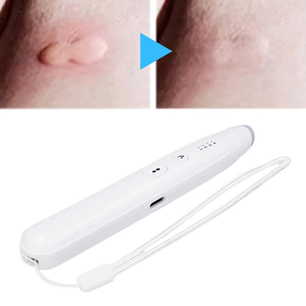 Rechargeable Bug Bite Itch Relief Pen | Heat Pulse Technology Bug Bite Relief Pen Vue