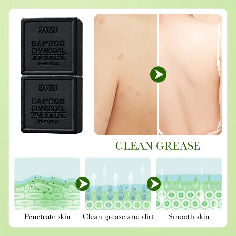 Cleansing, Bathing, Exfoliating, Gentle Cleansing, Oil-Controlling Essential Oil Soap, Rich in Foam, Easy to Rinse, Deeply Cleanses Skin Oils and Dirt, Cleanses the Skin and Removes Mites, Leaving Skin Refreshed and Comfortab Vue