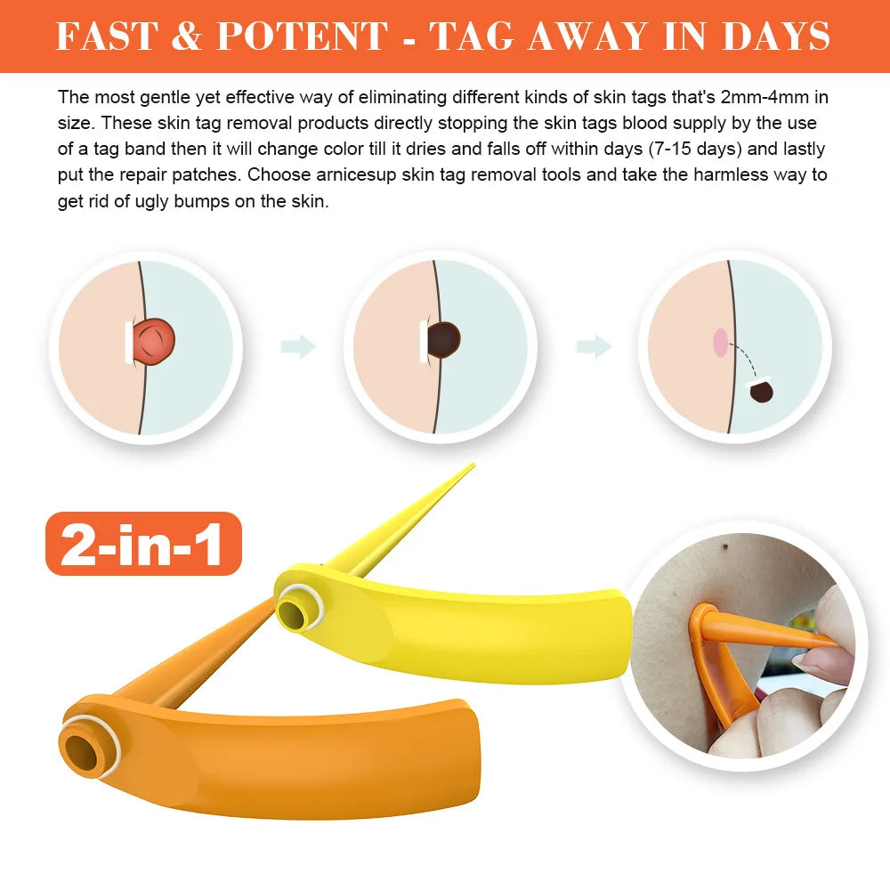 2-IN-1 Auto Skin Tag Removal Tool Kit Painless Skin Label Mole Acne Wart Removal Pen with Cleansing Swabs Facial Skin Care Tool Vue