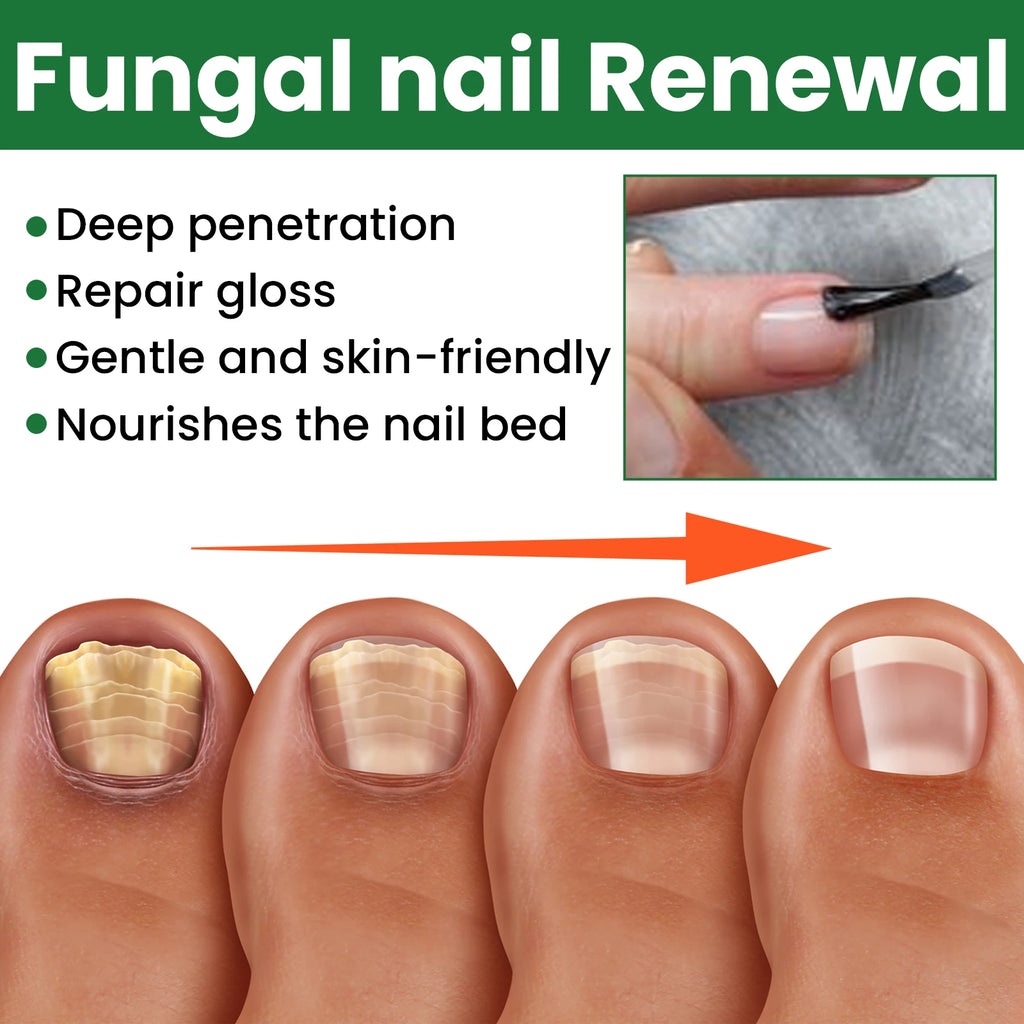 Nail Repair & Strengthening Liquid Repairs and Nourishes Nails, Brightens, Moisturizes and Protects, for Hand & Foot Nail Care. Vue