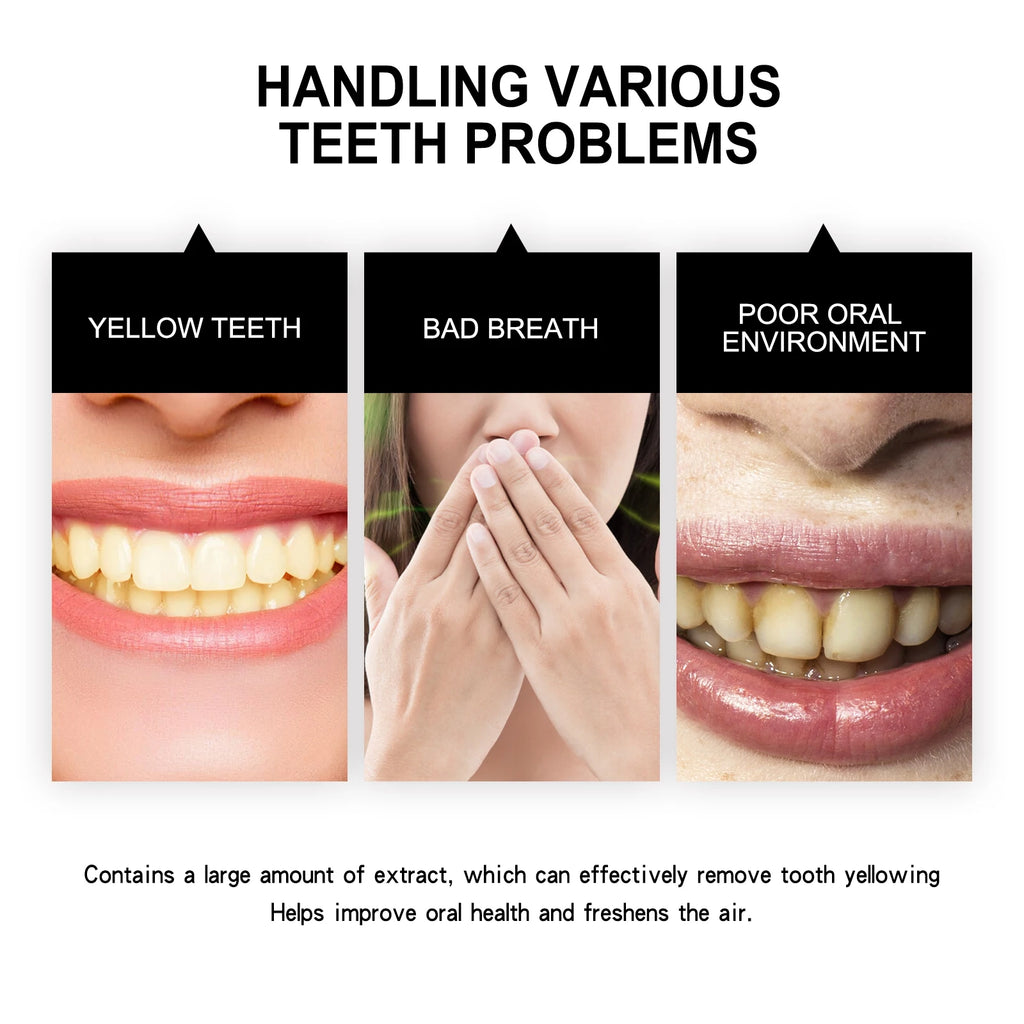 Activated Charcoal Teeth Whitening Powder - Tartar Cleaning, Yellow Stain Reduction, Smokers' Teeth Whitening & Oral Care Vue