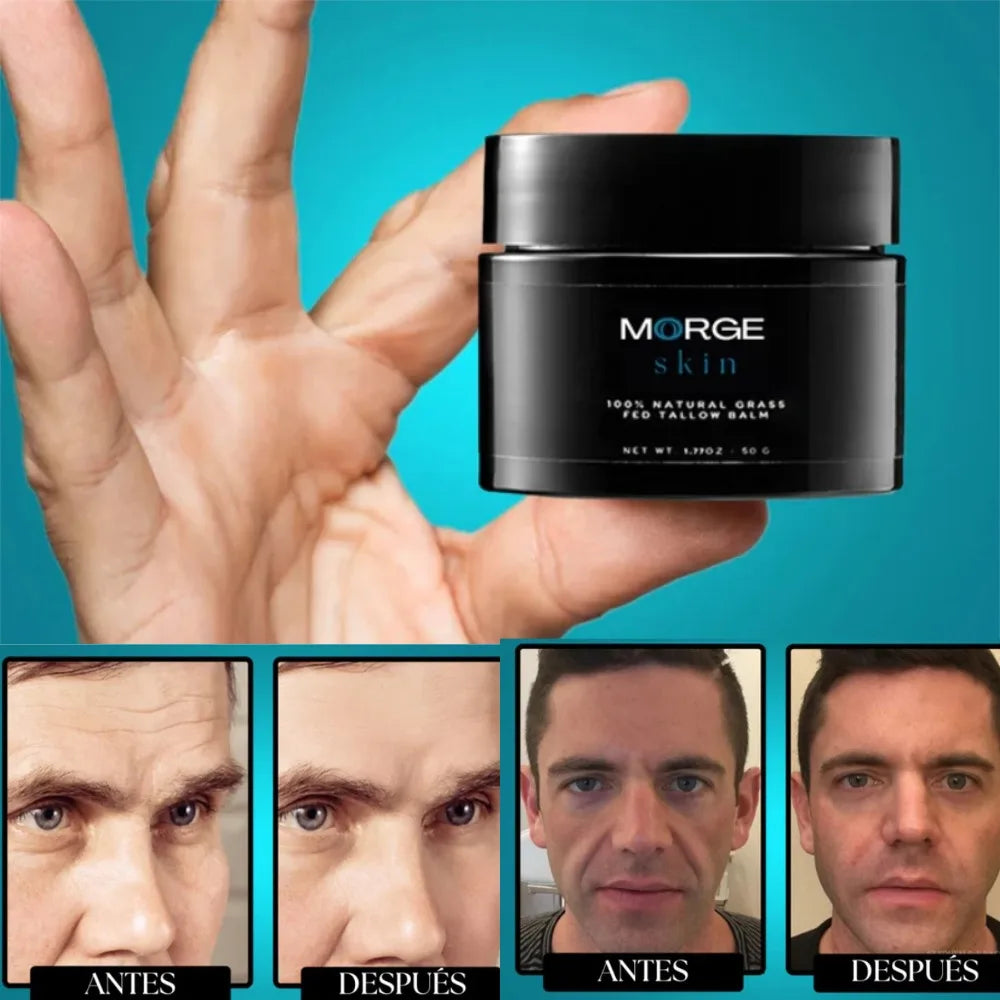 50g Original Forge Wrinkle Fine Lines Defense Tallow Balm Men's Morge Skin Brand 100% Natural Grass Fed Tallow Blam Moisturizer Vue