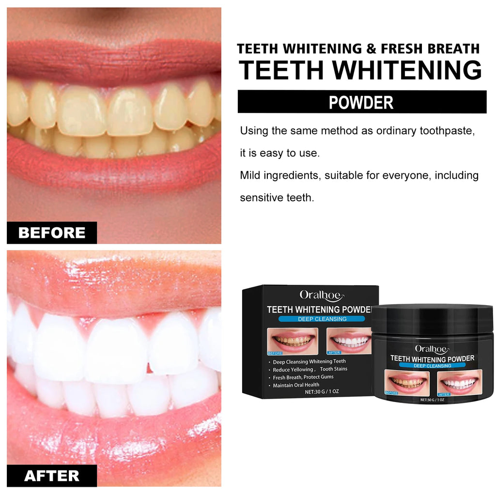 Activated Charcoal Teeth Whitening Powder - Tartar Cleaning, Yellow Stain Reduction, Smokers' Teeth Whitening & Oral Care Vue