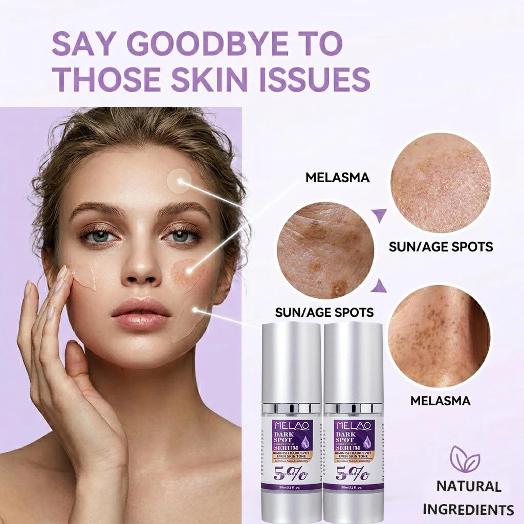 Dark Spot Remover for Face,Dark Spot Corrector Serum for Age Spot Sun Spot Freckles Melasma Brown Spot Skin Care Repair Cream Vue