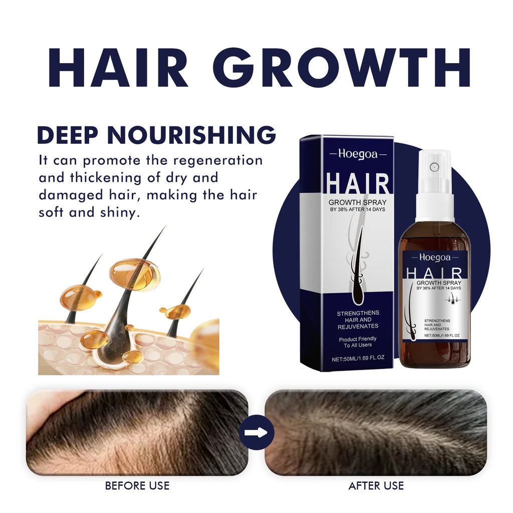 Hair Growth Spray Prevent Baldness Treatment Scalp Dry Damaged Split Hair Dense Strengthen Nourishing Smoothing Massage Liquid Vue