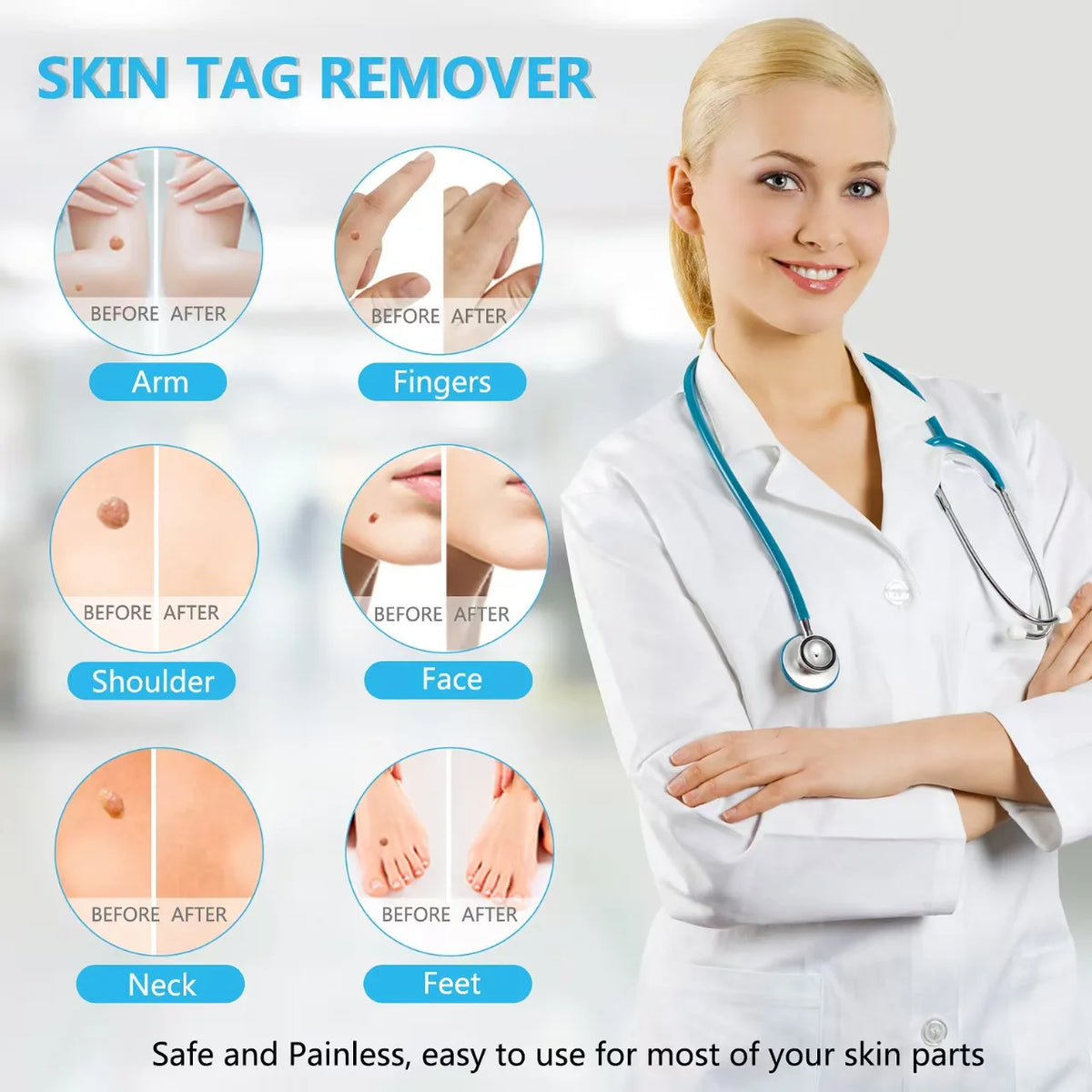 3 In 1 Auto Skin Tag Removal Kit Painless Mole Wart Remover Equipment Micro Skin Tag Treatment Tool Easy To Clean Skin Care Tool Vue