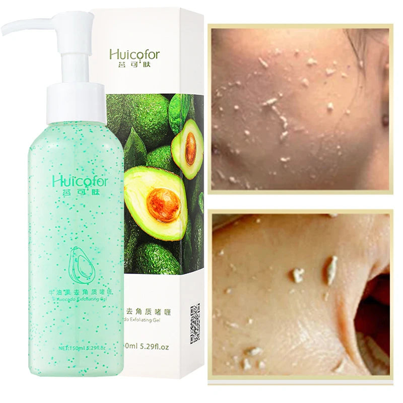 Fruit Acid Peeling Gel 120ml Facial Cleansing Exfoliating Peeling Scrub Deep Clean Acne Blackhead Remove Face Cleanser Vue