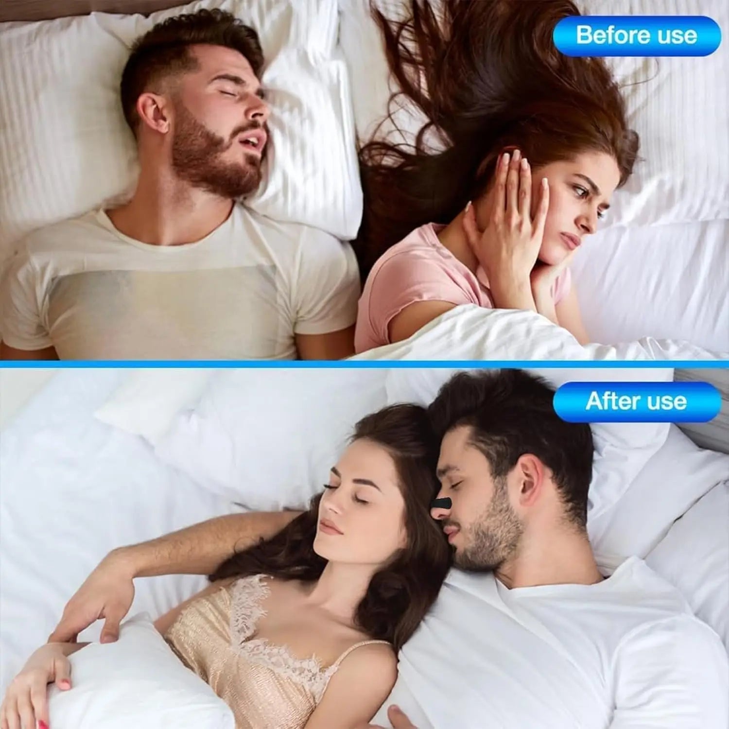 Anti Snoring Nose Strips Breathing Correction Physical Expansion