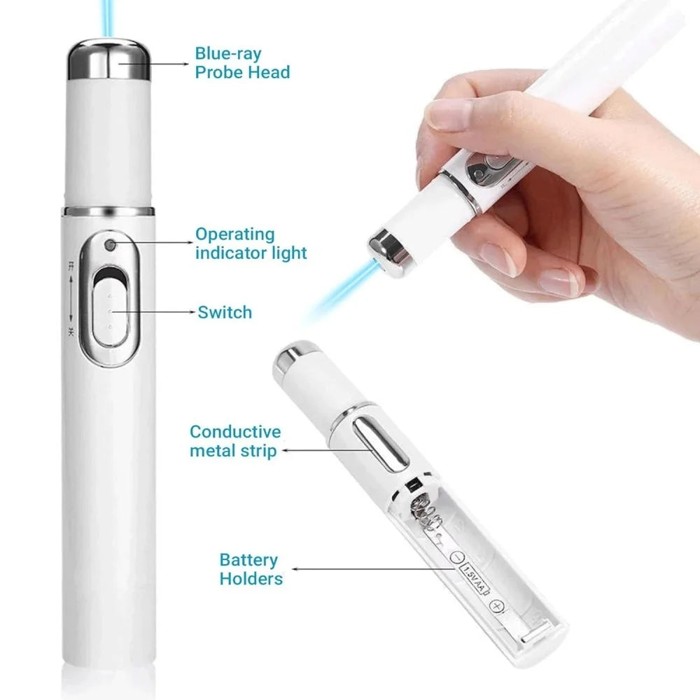 Blue Light Eye Massager Facial Beauty Device Lighten Dark Circles Eye Bags Reduce Fine Lines Skin Care Tool for Home Maintenance Vue
