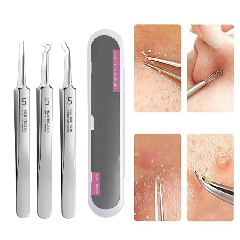 Pro Ultra Fine No.5 Blackhead Remover Tweezers Acne Pimple Needle Deep Facial Cleansing Clip Set Available Home Skin Care Tool Vue