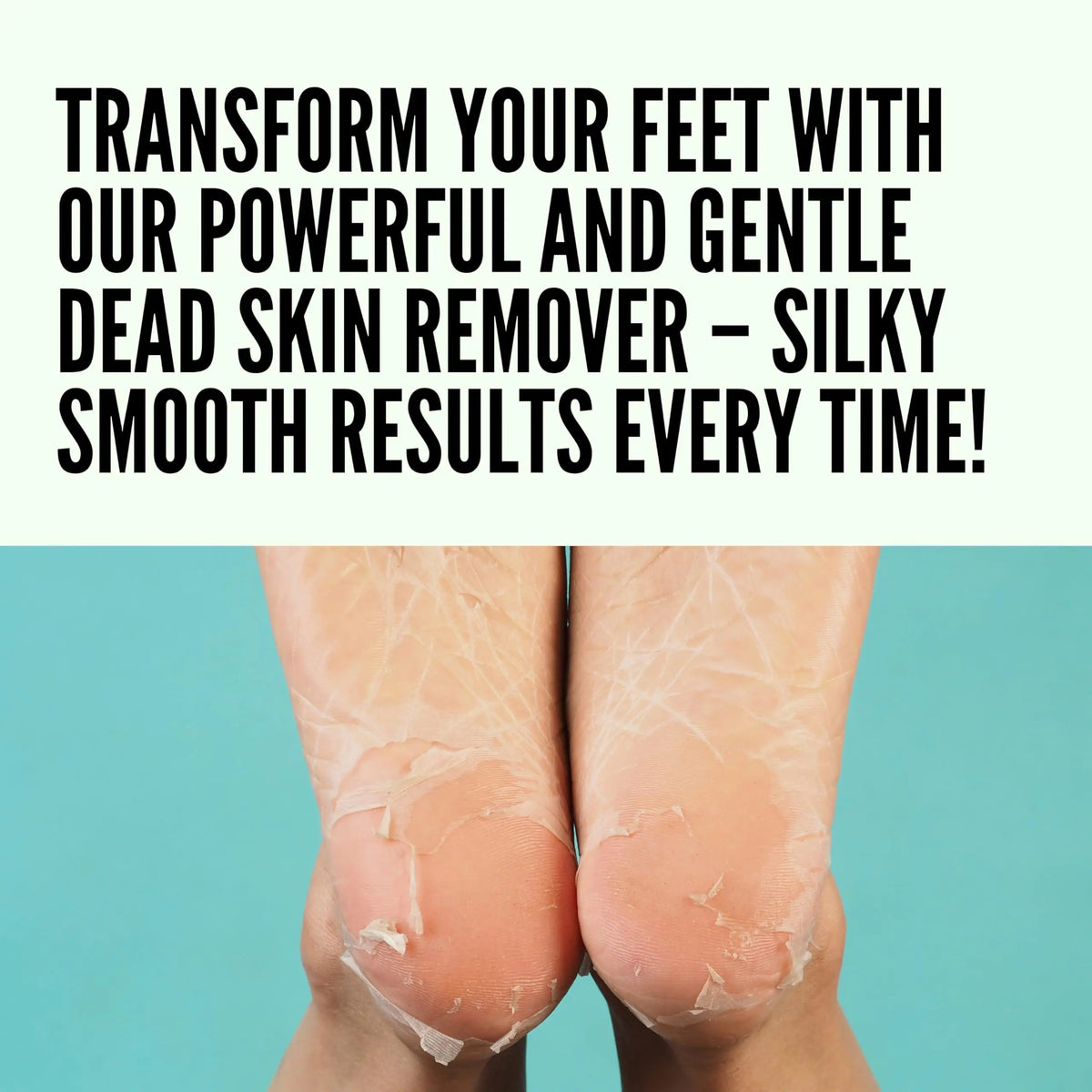 1 Pcs Professional Stainless Steel Callus Remover Foot File Scraper Pedicure Tools Dead Skin Remove for Heels Feet Care Products Vue