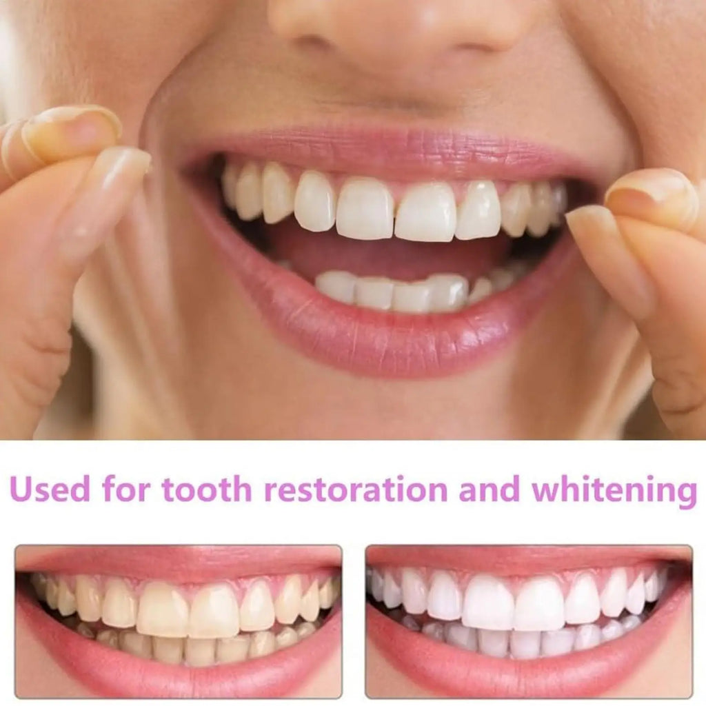 1 pair Teeth Veneers Men Women Brightening Dentures Temporary False Teeth Cover Instant Imitation Braces For Confidence Smile Vue