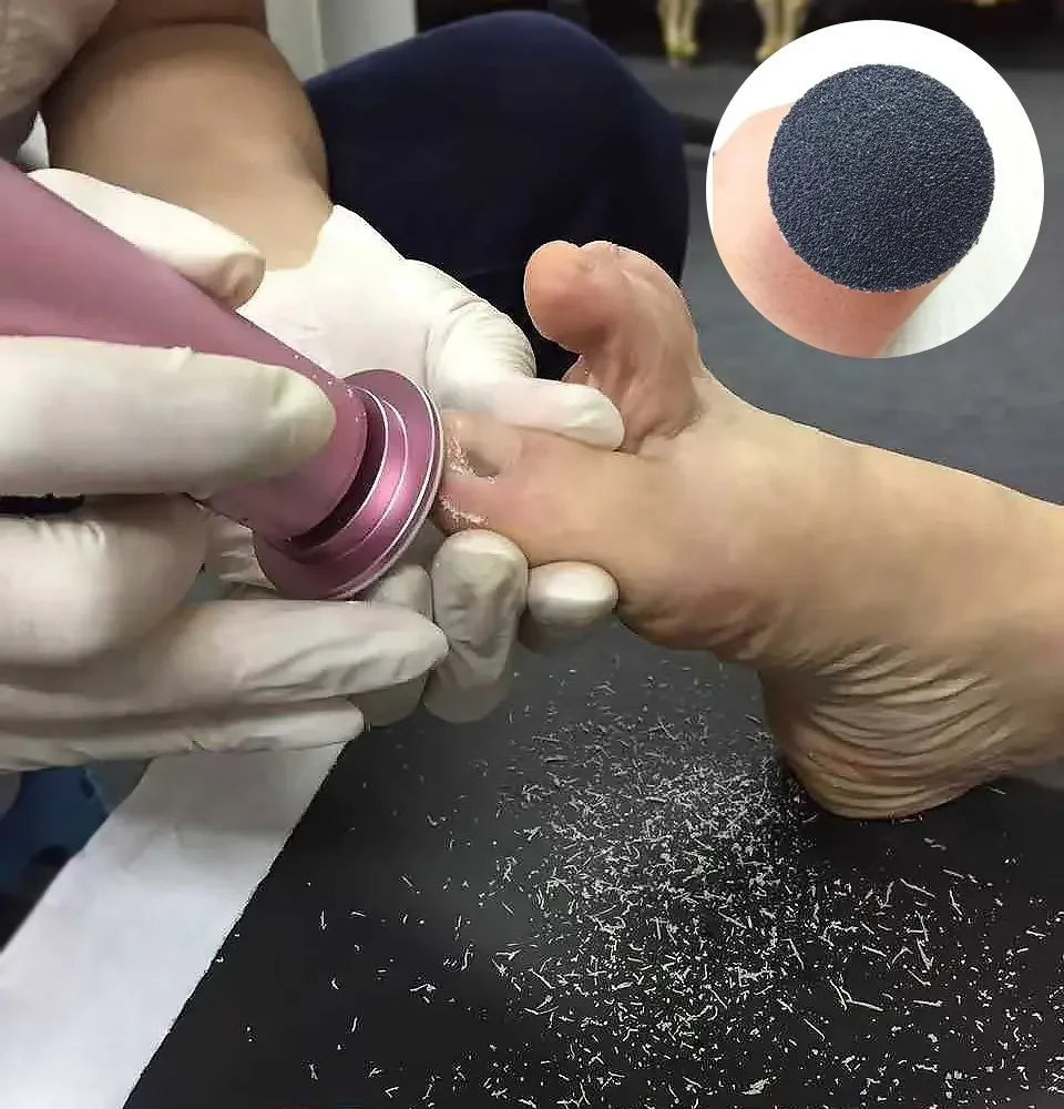 60 PCS/Lot Tool Foot File Sandpaper Disk Sanding Foot Callus Remover Replacement Paper Accessory For Electric Tool Pedicure Vue