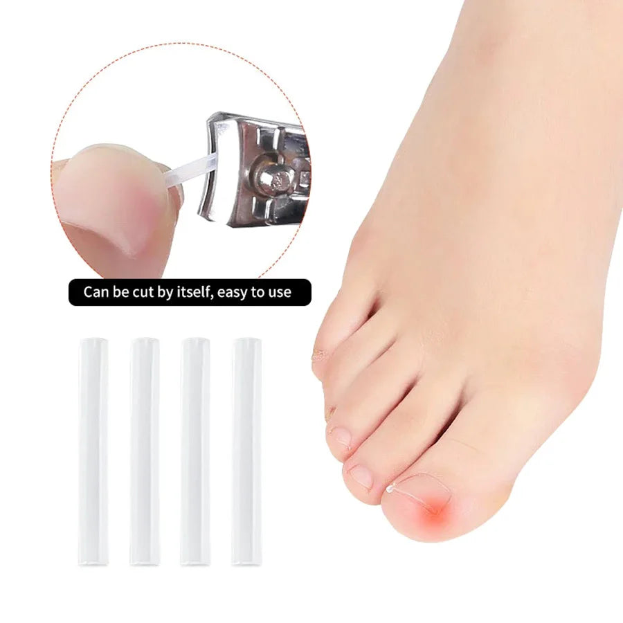Elastic C-shaped Tube Pad for Toe Nail Ingrown Toenail Corrector Tools Foot Care Invisible Groove Straightening Clip Treatment Vue