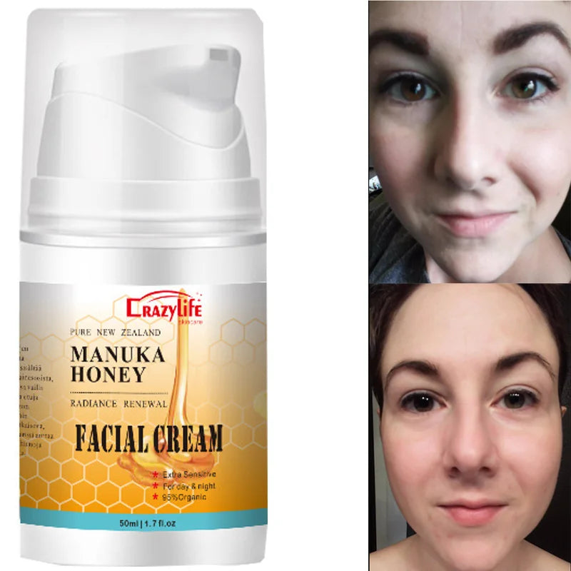 50ml NewZealand Bee Venom Honey Facial Cream Firming Lifting Skin Treatment Facial Cream Calming Night Cream Vue Default Title