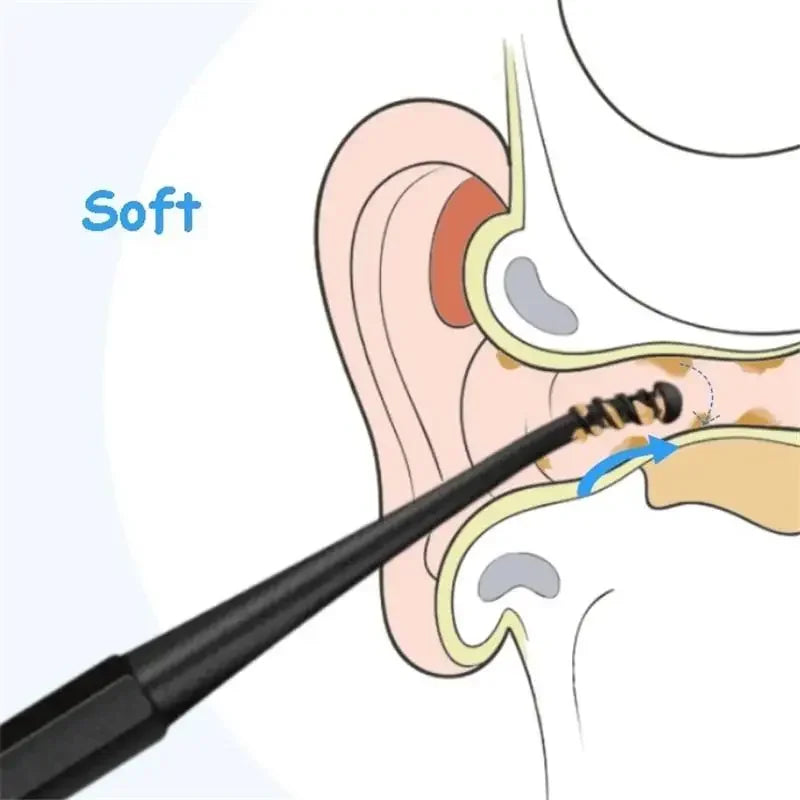 Double Soft Silicone Head Rotary Screw Earpick Reusable Ear Picking Tool Massage Cleaner Earwax Removal Ear Scoop Rod Home Use Vue