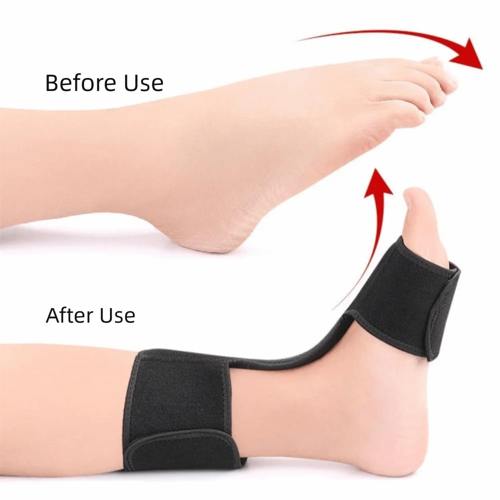 Aluminum Bar Support Foot Splint Brace Elastic Adjustment Dorsal Drop Foot Orthopedic Brace Skin-friendly Comfortable Vue
