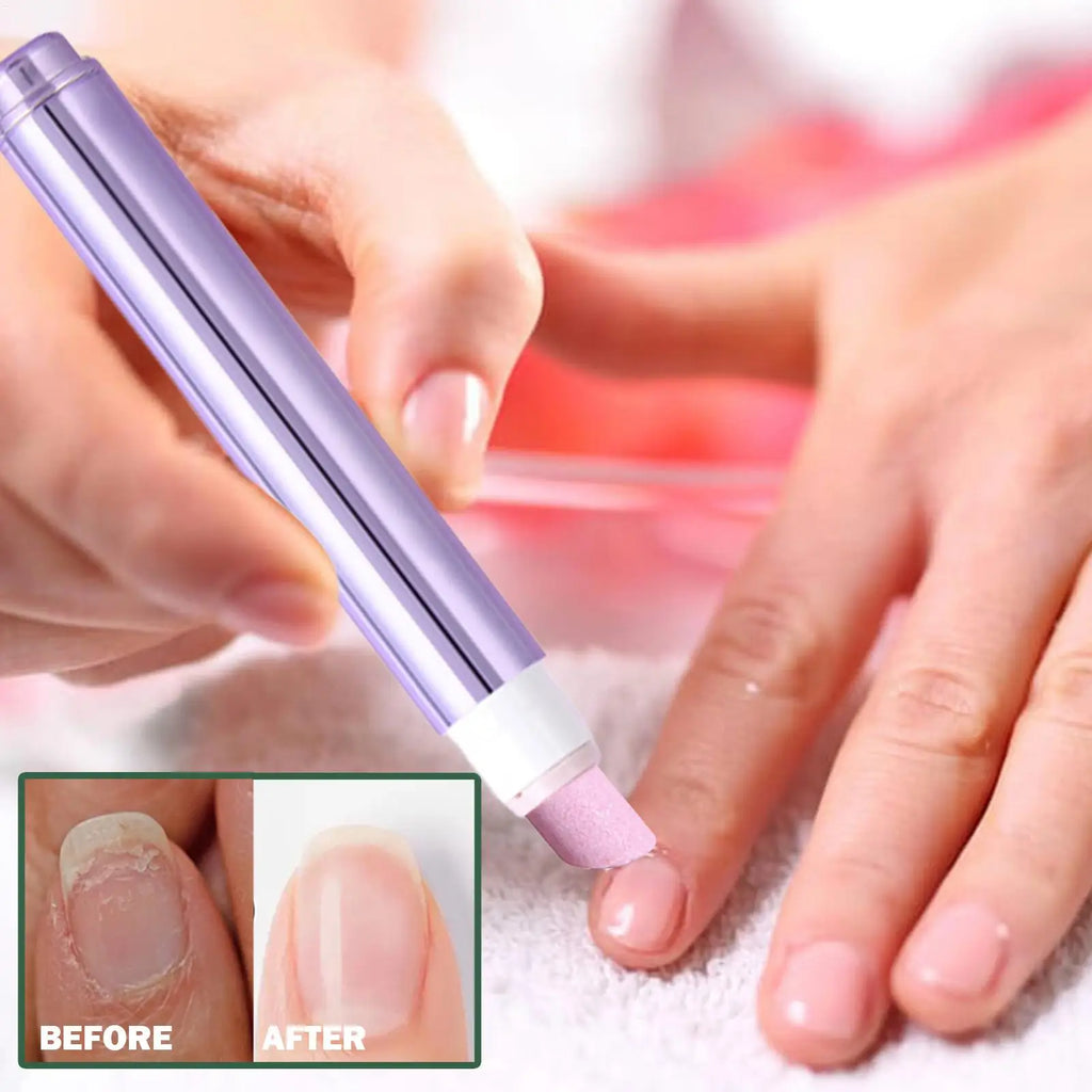 Nail Strengthener Damaged Nail Care Chip-resistant Cuticle Remover Pen for Nourishing Split Cracked Youth Weak Thin Men Elderly Vue