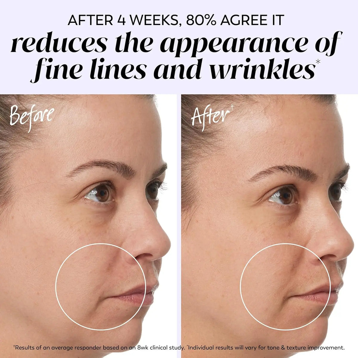 Layered Pore Bacteria Wrinkle Remover Face Cream Firming Lifting Anti Aging Fade Fine Lines Moisturizing Whitening Repair Skin Vue