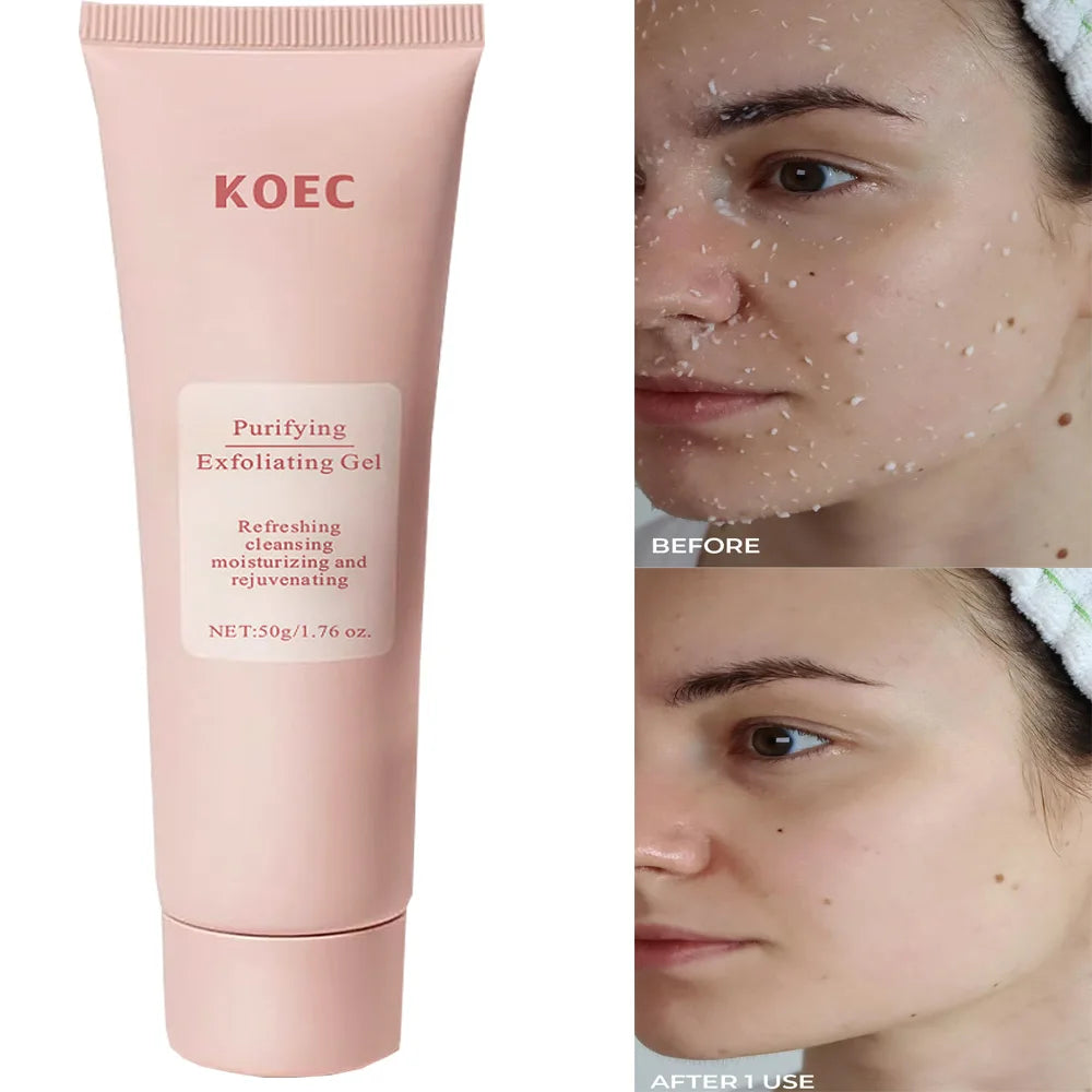 Revitalize Skin Fruit Acid Peeling Gel Facial Cleansing Exfoliating Peeling Scrub Deep Clean Acne Blackhead Remove Face Cleanser Vue Default Title