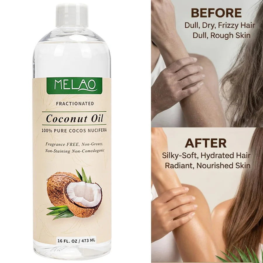 473ml Cold-Pressed Coconut Pure Essential Oil Skin Care Hair Care Soap Making DIY Making Massage Moisturize Aromatherapy Vue