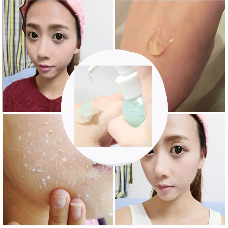 Fruit Acid Peeling Gel 120ml Facial Cleansing Exfoliating Peeling Scrub Deep Clean Acne Blackhead Remove Face Cleanser Vue