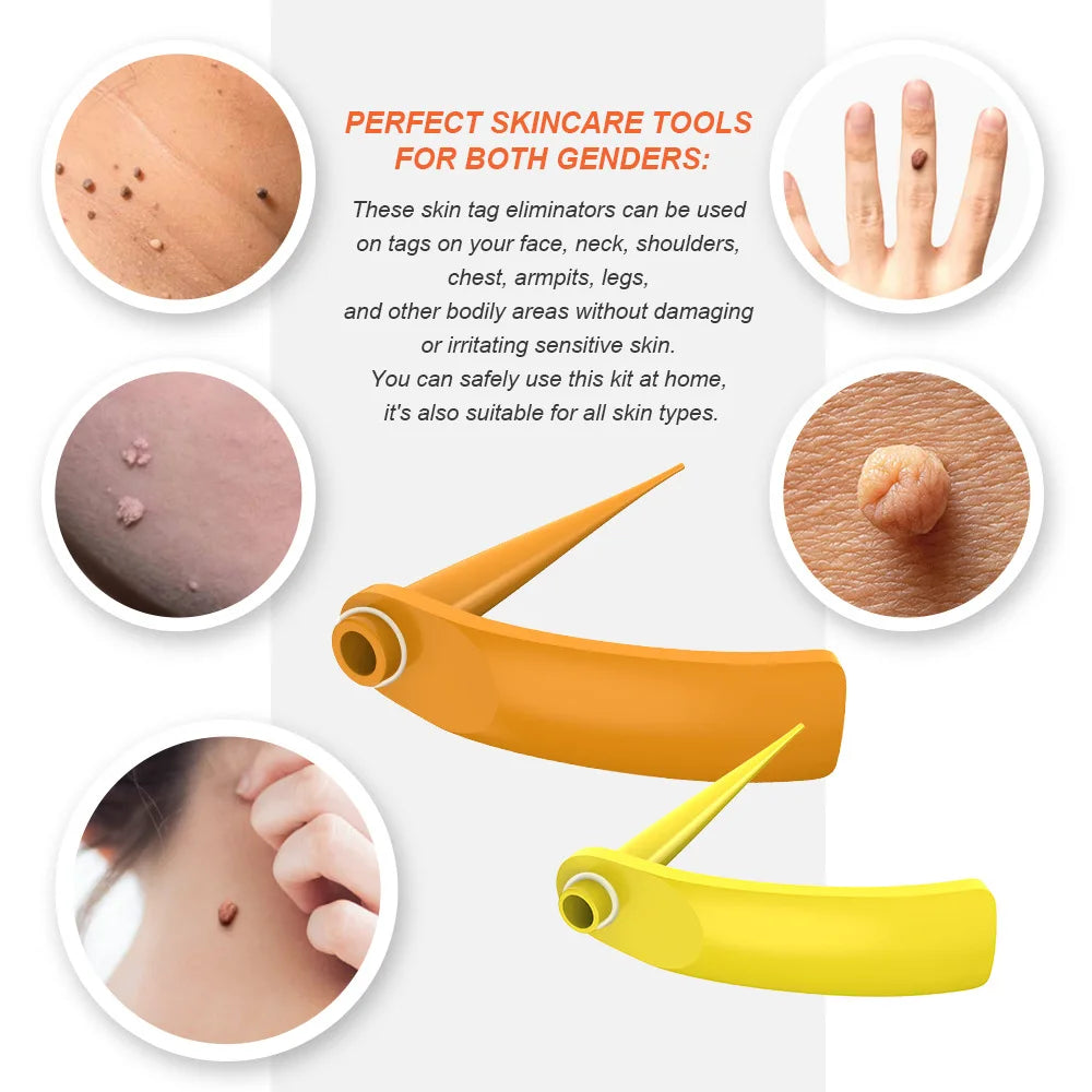 2-IN-1 Auto Skin Tag Removal Tool Kit Painless Skin Label Mole Acne Wart Removal Pen with Cleansing Swabs Facial Skin Care Tool Vue