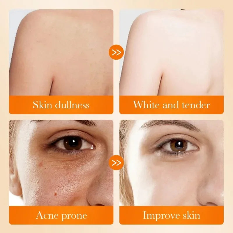 Sadoer Kojic Acid Facial Soap Face Wash Foam Facial Cleanser Moisturizing Hydrating Oil Control Body Bathing Handmade Soap Vue