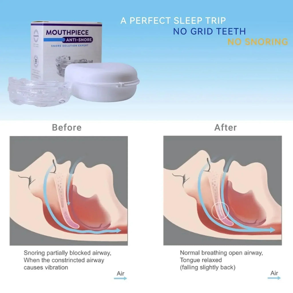 Adjustable Anti-snoring Mouth Guard Mouthpiece Bruxism Snoring