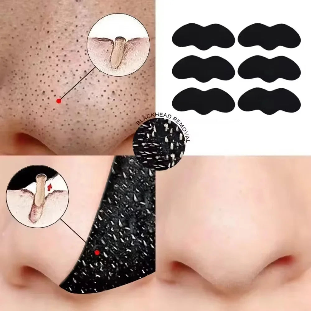 Deep Cleansing Pore Unclog Blackhead Removal Nose Strips 10/20/50/100 Pieces Refreshing Oil Control Facial Skin Care Patch Vue