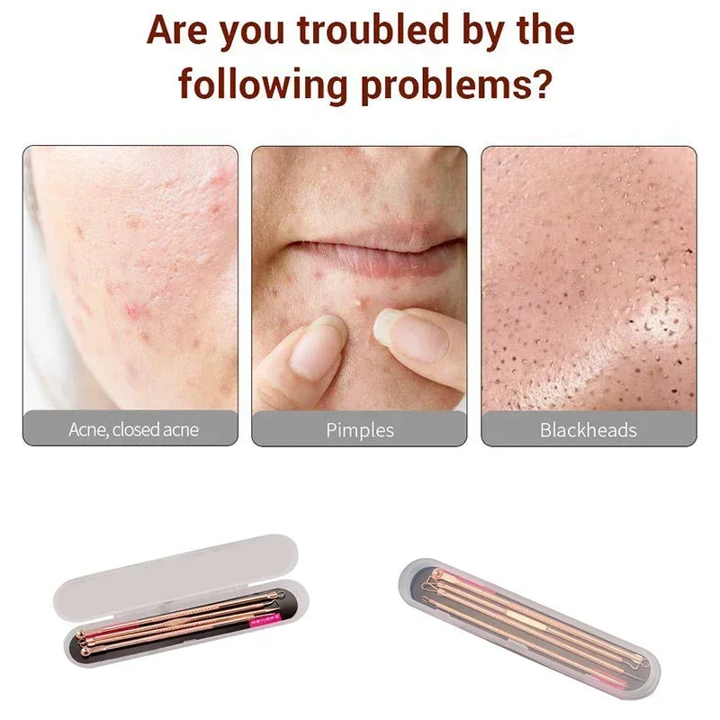 4pcs Removal Tools Blackhead Pimple Pin Acne New Makeup Set Beauty Needle Stainless Steel Acne Needle Pimple Needle Acne Vue