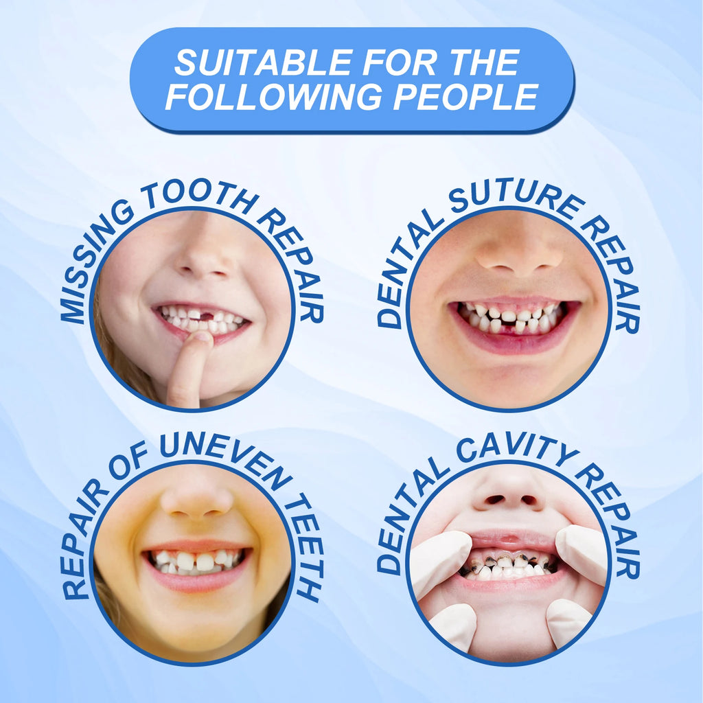 Solid Dental Gel, Soft Material for Comfortable Daily Wear with No Foreign Body Sensation, Effectively Beautifies Your Teeth. Vue