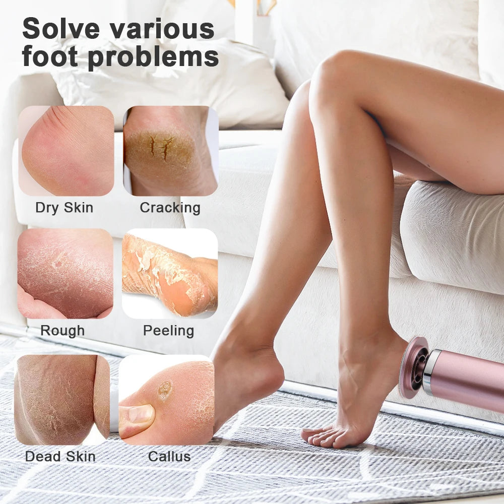 Wireless Electric Foot Grinder USB Rechargeable Heel File Grinding Exfoliator Pedicure Machine Feet Care Manicure Salon Tools Vue