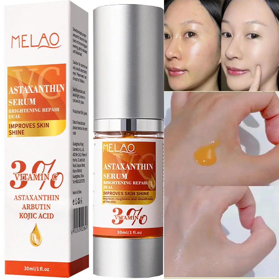 VC Astaxanthin Whitening Serum Remove Dark Spots Freckles Fade Melanin Anti-Wrinkle Brightening Nourishing Face Skin Care Vue
