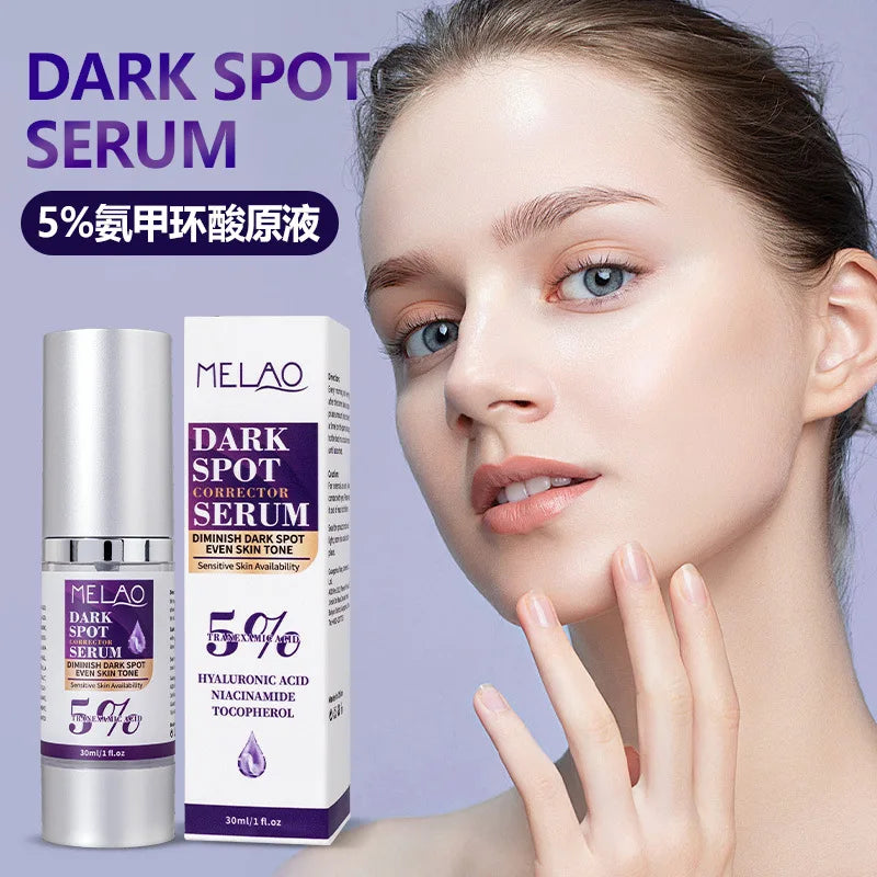 Dark Spot Remover for Face,Dark Spot Corrector Serum for Age Spot Sun Spot Freckles Melasma Brown Spot Skin Care Repair Cream Vue
