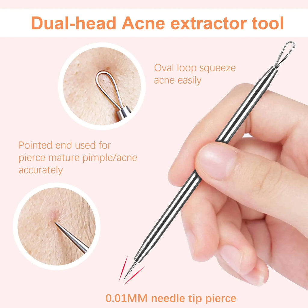 Blackhead Tweezers, Milia Remover, Pimple Popper Tool,Ingrown Hair Tweezers, Blackhead Extractor Vue